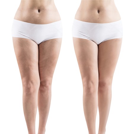 action anti cellulite