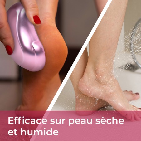 solution anti-corne pieds